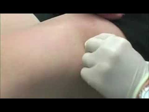 See video