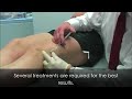 Sclerotherapy Procedure-Radiant Complexions Dermatology Clinics Sclerotherapy Procedure-Radiant Complexions Dermatology Clinics