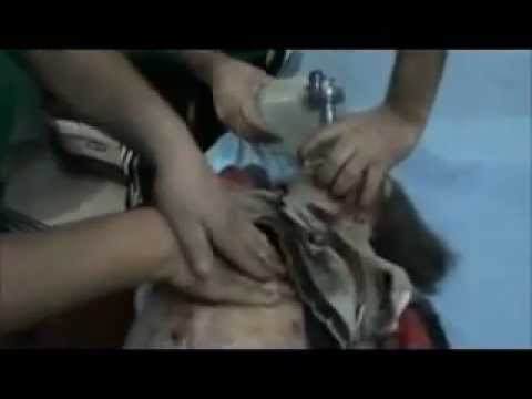 Imagen de previsualización de YouTube