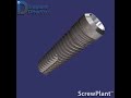 ScrewPlant Implant