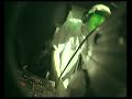 a034 liveset 2007 cox18