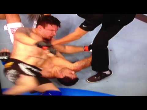 Mir arm break VS Nogueira