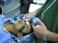 Precautions in General Anaesthesia in Pediatric Dentistry Precautions in General Anaesthesia in Pediatric Dentistry