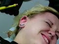 8mm Dermal Punch 8mm Dermal Punch
