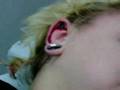 8mm Dermal Punch