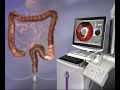 GI View - Overview GI View - Overview