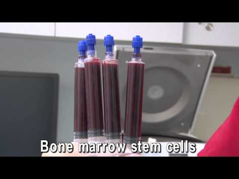 how to isolate bone marrow stem cells
