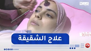 women / علاج الشقيقة بالإبر الصينية