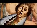trepanated earth