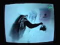 Varnagel - Kanal Fem