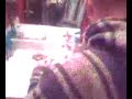 Yummy Cyst