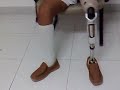 ي  Artificial limb prostheses
