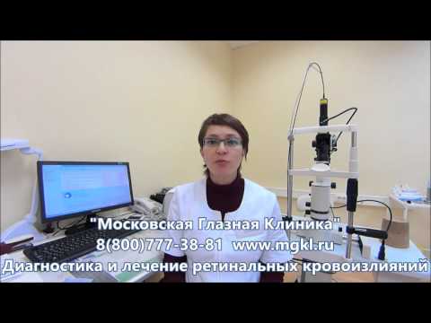 Видео Кровоизлияние в сетчатку (ретинальное кровоизлияние)