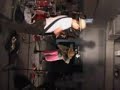Spermatic Chord LLNR Fest (Part 4 of 4) Spermatic Chord LLNR Fest (Part 4 of 4)