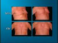 Male Plastic Surgery as seen on CNN Male Plastic Surgery as seen on CNN