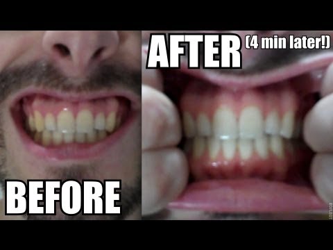 how to whiten teeth with essential oils