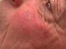 dr  coyle connolly talks about the importance of skin cancer