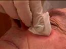dr  coyle connolly talks about the importance of skin cancer