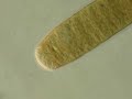 Cyanobacterial Filament 1000x