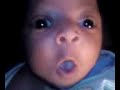 Baby Dre hates the hiccups Baby Dre hates the hiccups