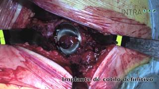 Luis Clavel Rojo-8