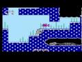 walkthrough of 1992 nes game - big nose freaks out.