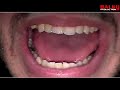 french rap