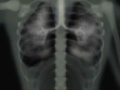 El largo viaje del humo por tus pulmones