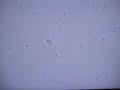 Listeria with tumbling motility