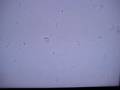 Listeria with tumbling motility