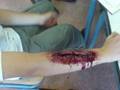 videos de Grime wonden