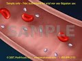 2D Medical Animation: Clot Formation and Clot Breakdown