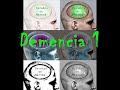 Cerebro de Marcus - Demencia 1 Cerebro de Marcus - Demencia 1