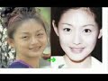 Taiwanese Plastic Surgery Taiwanese Plastic Surgery