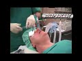 MedTV-medpodcast: Combitube ORIGINAL live Intubation MedTV-medpodcast: Combitube ORIGINAL live Intubation