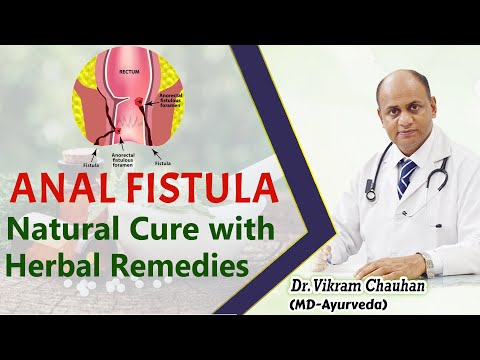 how to cure fistula