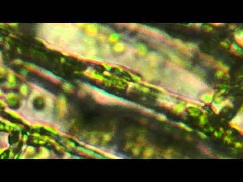 Microscope View of Plant Cells