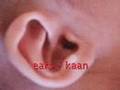 Body Parts (face) in Bangla Navadvip Street