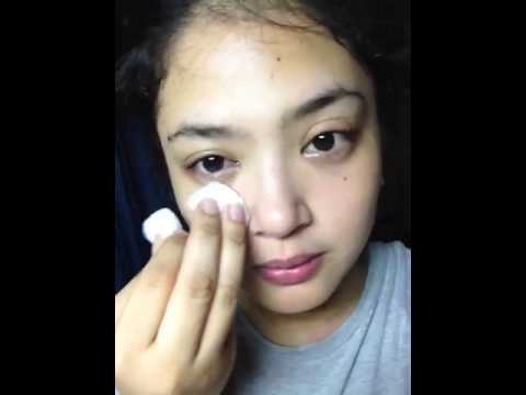 how to cure swollen eyes