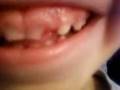 videos de Lost his first tooth