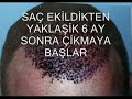 20-lik-di-gml-di-ameliyat-.html