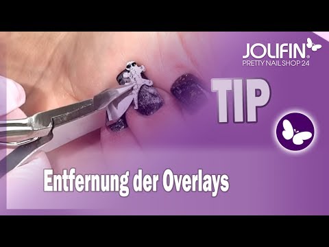 Entfernung der Overlays