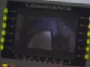 Double Video Player