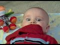 Foot in mouth syndrome