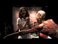 Shoulder Injuries A Kinetic Chain Approach