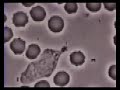 Neutrophil phagocytosis Neutrophil phagocytosis