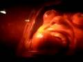 Total Recall: bulging eyes