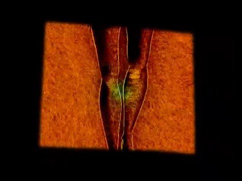 Image de prévisualisation YouTube