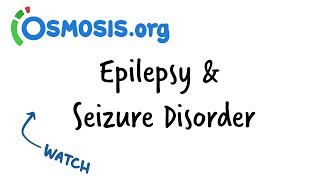Epilepsy & Seizure Disorder  Clinical Presenta