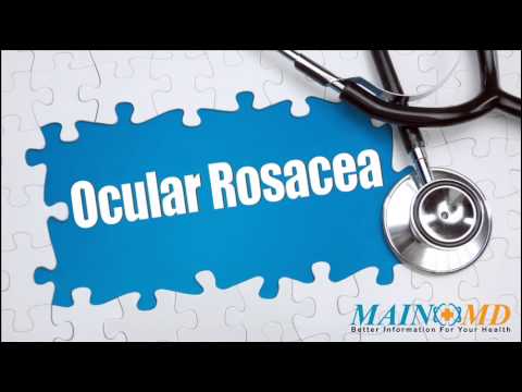 how to treat ocular rosacea